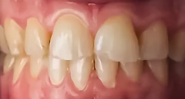 FacDen3-extra7 copy